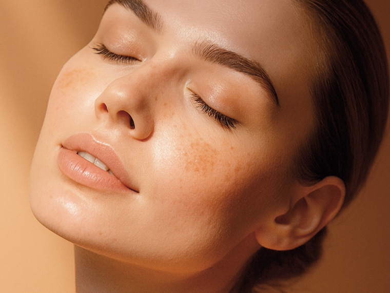 Нарушение пигментации